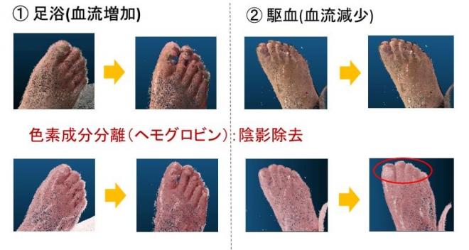 【2024年大学見本市】肌カラー画像からの色素成分分離技術とその応用